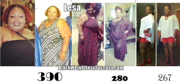 Lesa weight loss surgery