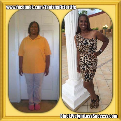 Tanisha weight loss surgery