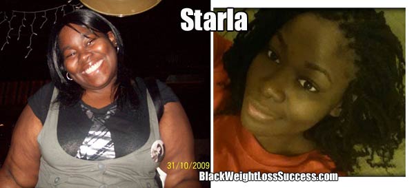 starla before and after