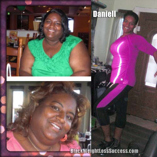 Daniell after gastric bypass