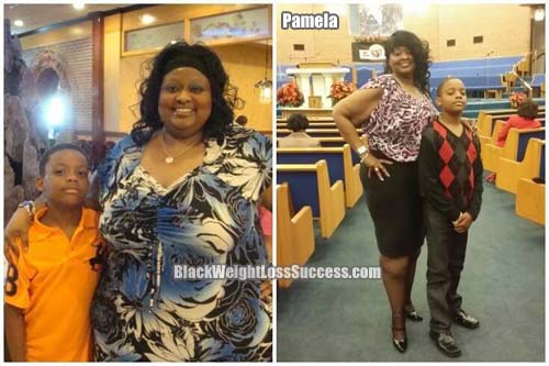 Pamela weight loss surgery story