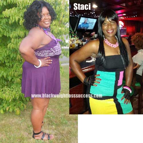 Staci before and after