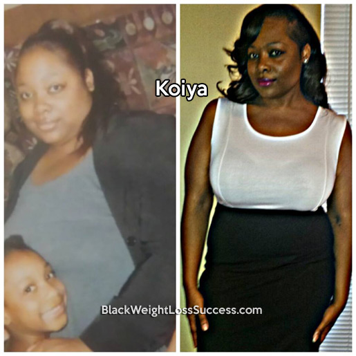 koiya before and after