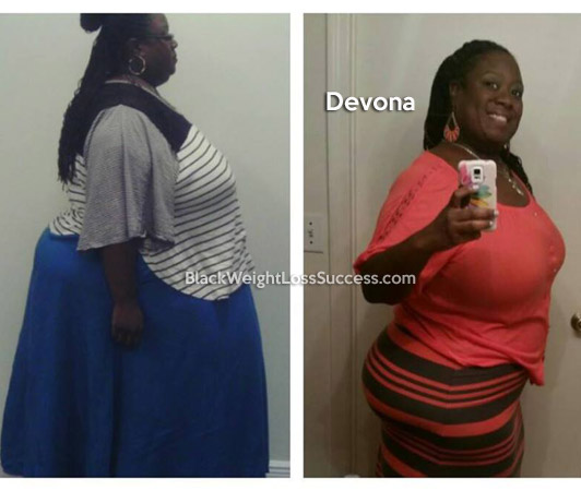 Devona before and after