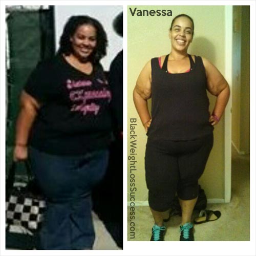 vanessa before and after
