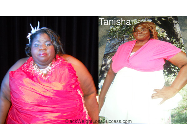 Tanisha before and after