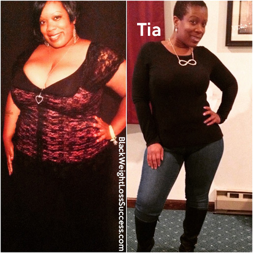 Tia before and after