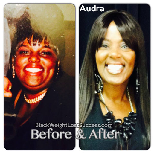 audra before and after