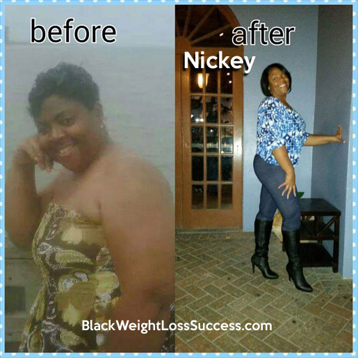 nickey before and after