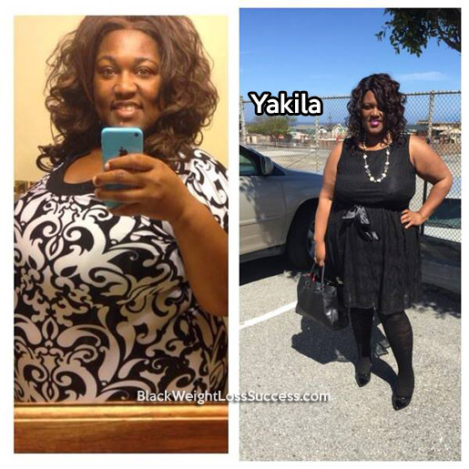 Yakila before and after