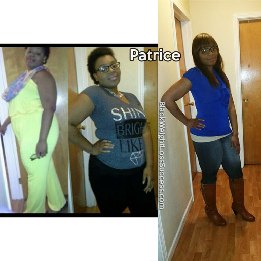 patrice before and after