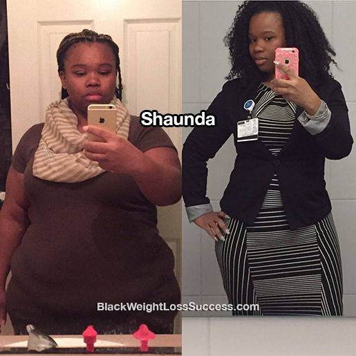 shaunda before and after
