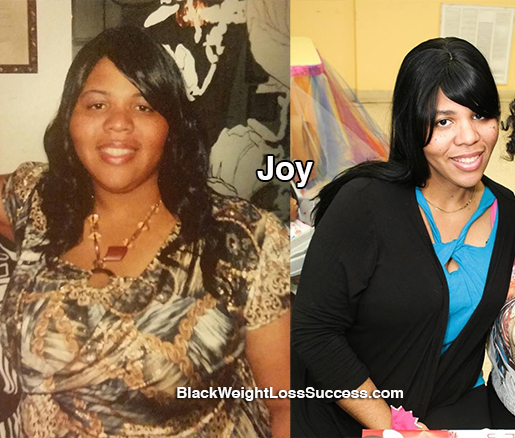 joy weight loss surgery