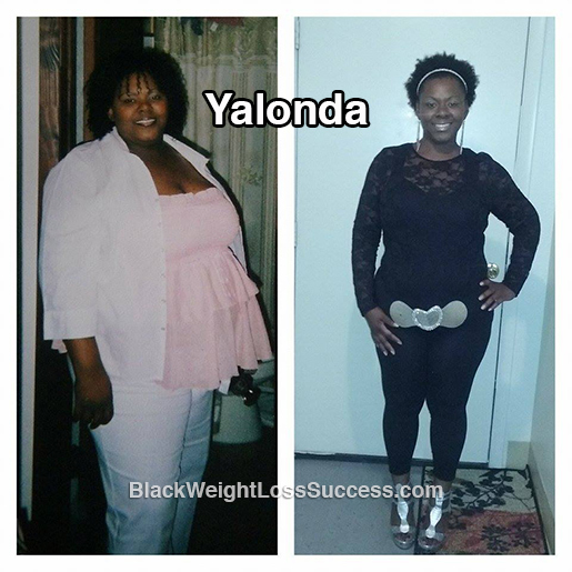 yalonda before and after