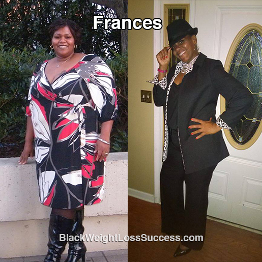 frances before and after