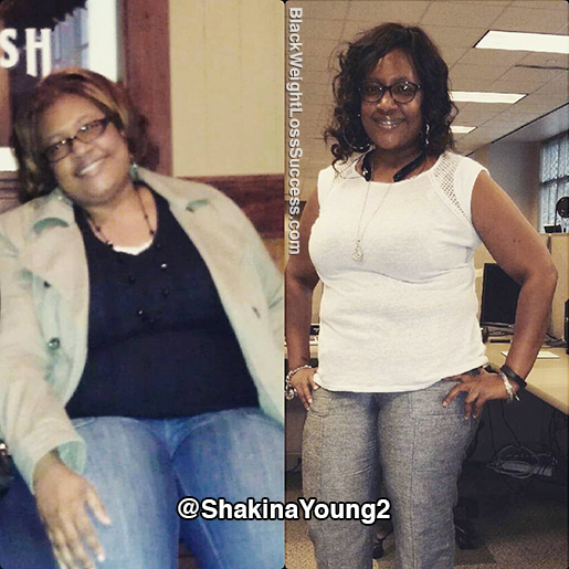 shakina before and after
