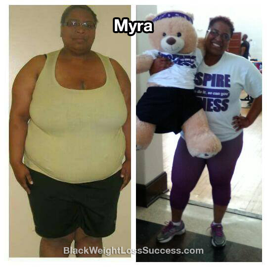 myra before and after