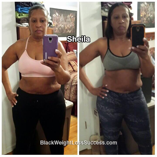 sheila before and after