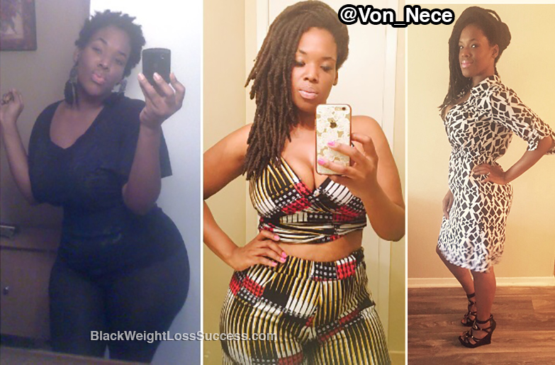 Vonna before and after