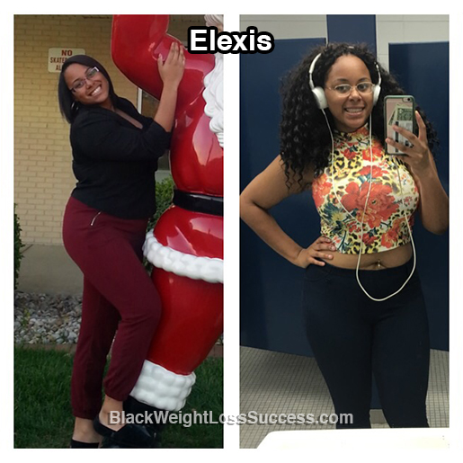 Elexis before and after