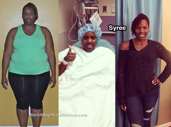 syree before and after