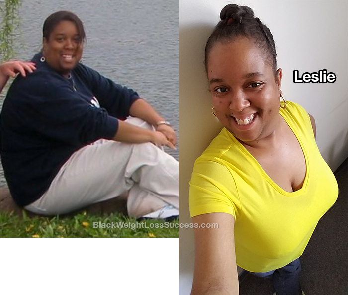 leslie before and after