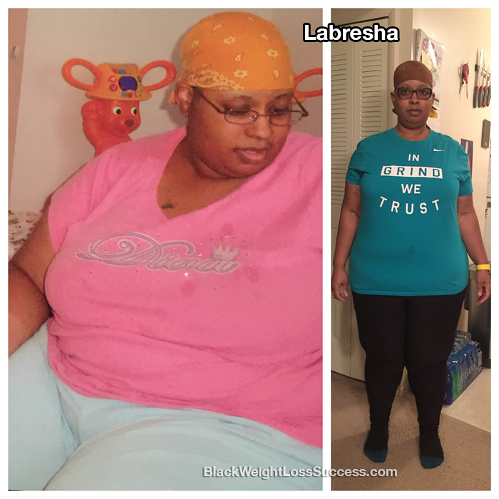 Labresha before and after