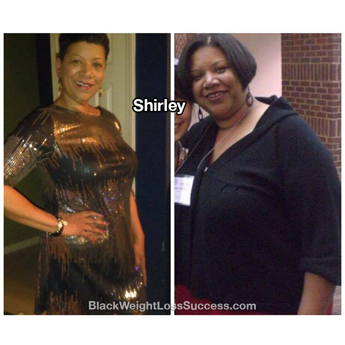 Shirley weight loss