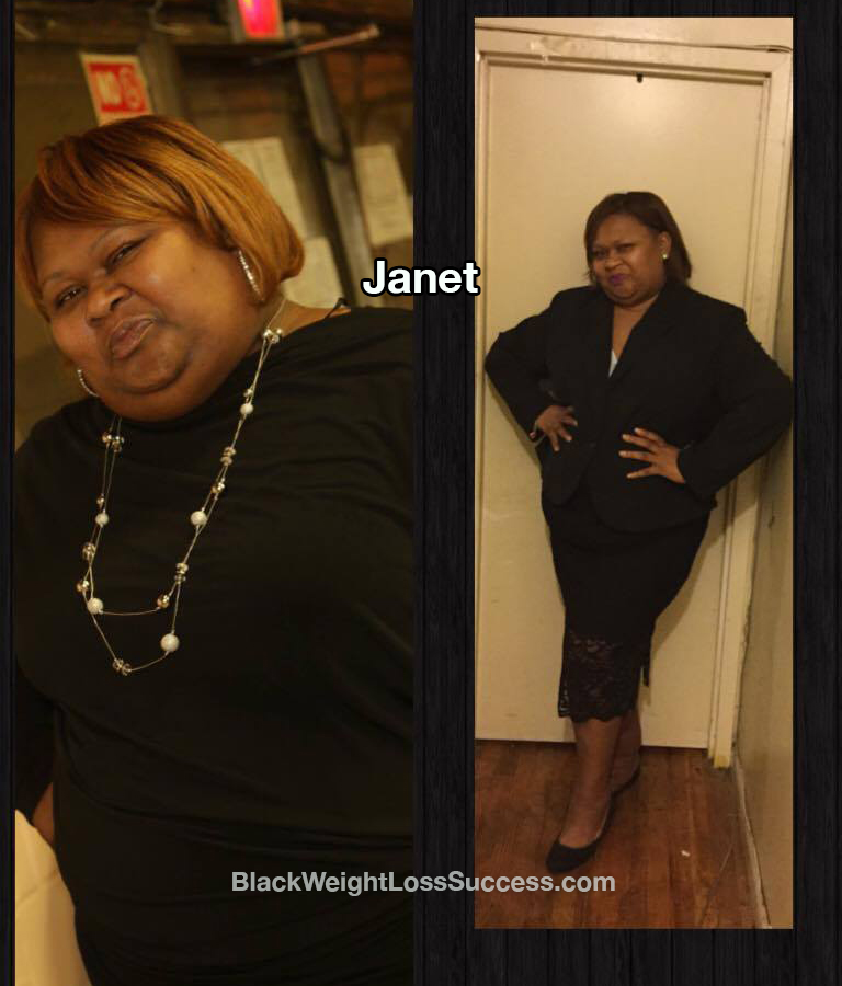janet before and after