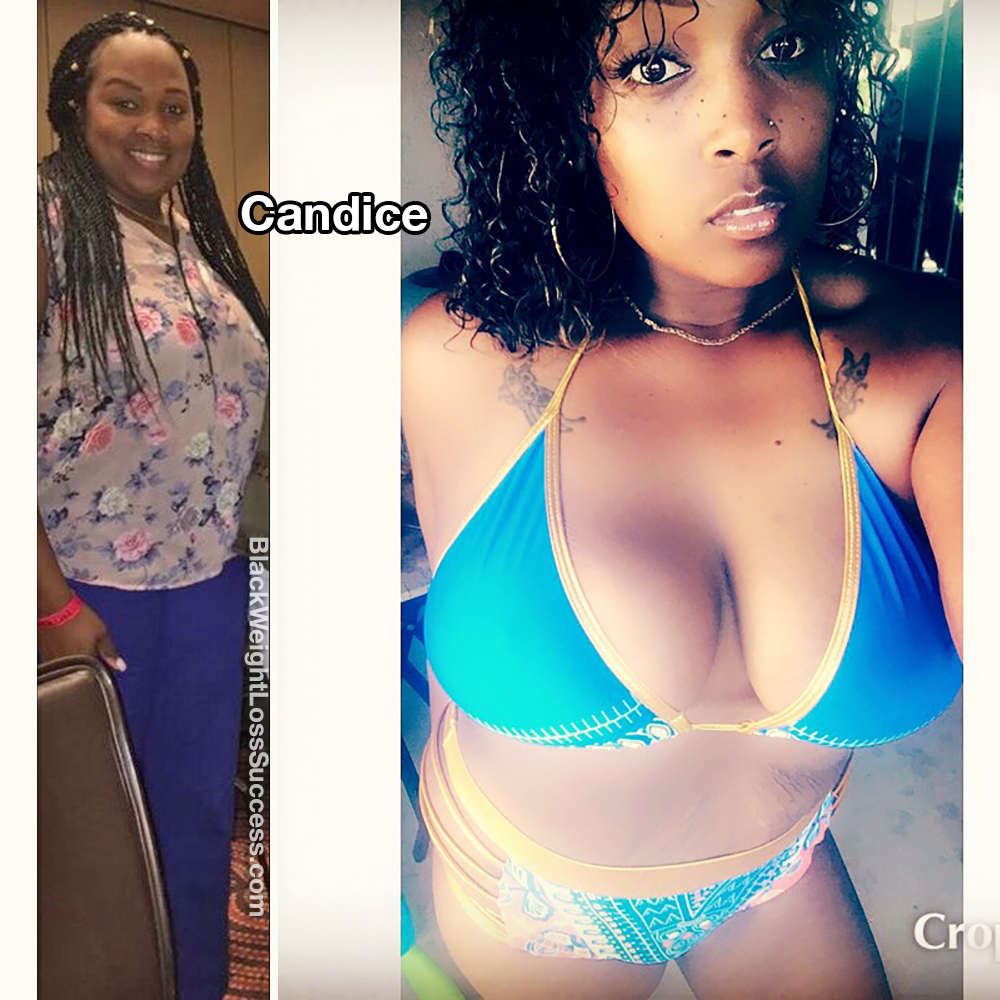 candice before and after