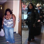 Monica weight loss surgery