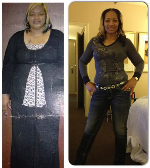 gastric bypass before and after black women