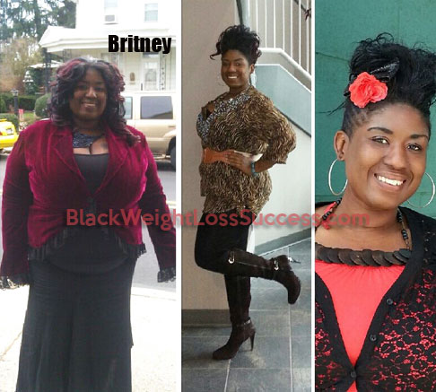 gastric bypass before and after black women