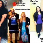 Beverly weight loss before and after
