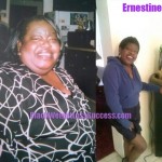 Ernestine weight loss surgery