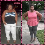 Janeisha weight loss surgery