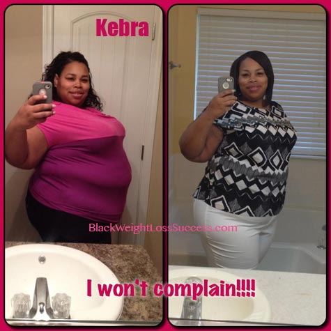 gastric bypass before and after black women