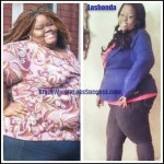 Lashonda weight loss surgery