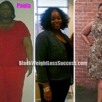 Paula weight loss surgery