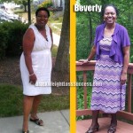 Beverly weight loss before and after