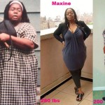Maxine lapband weight loss