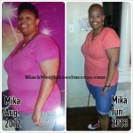 Mika weight loss surgery success