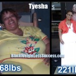 Tyesha weight loss surgery