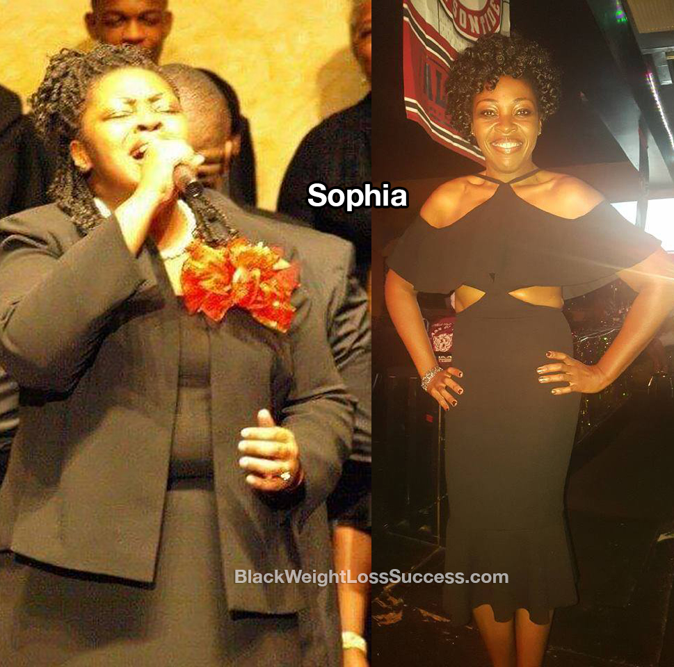 sophia before and after