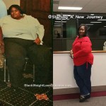 marcia weight loss surgery