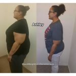 ashley weight loss surgery