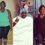 syree before and after
