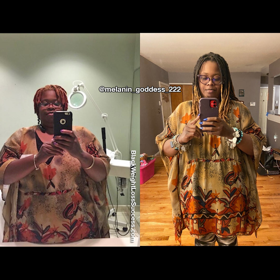 Erika before and after