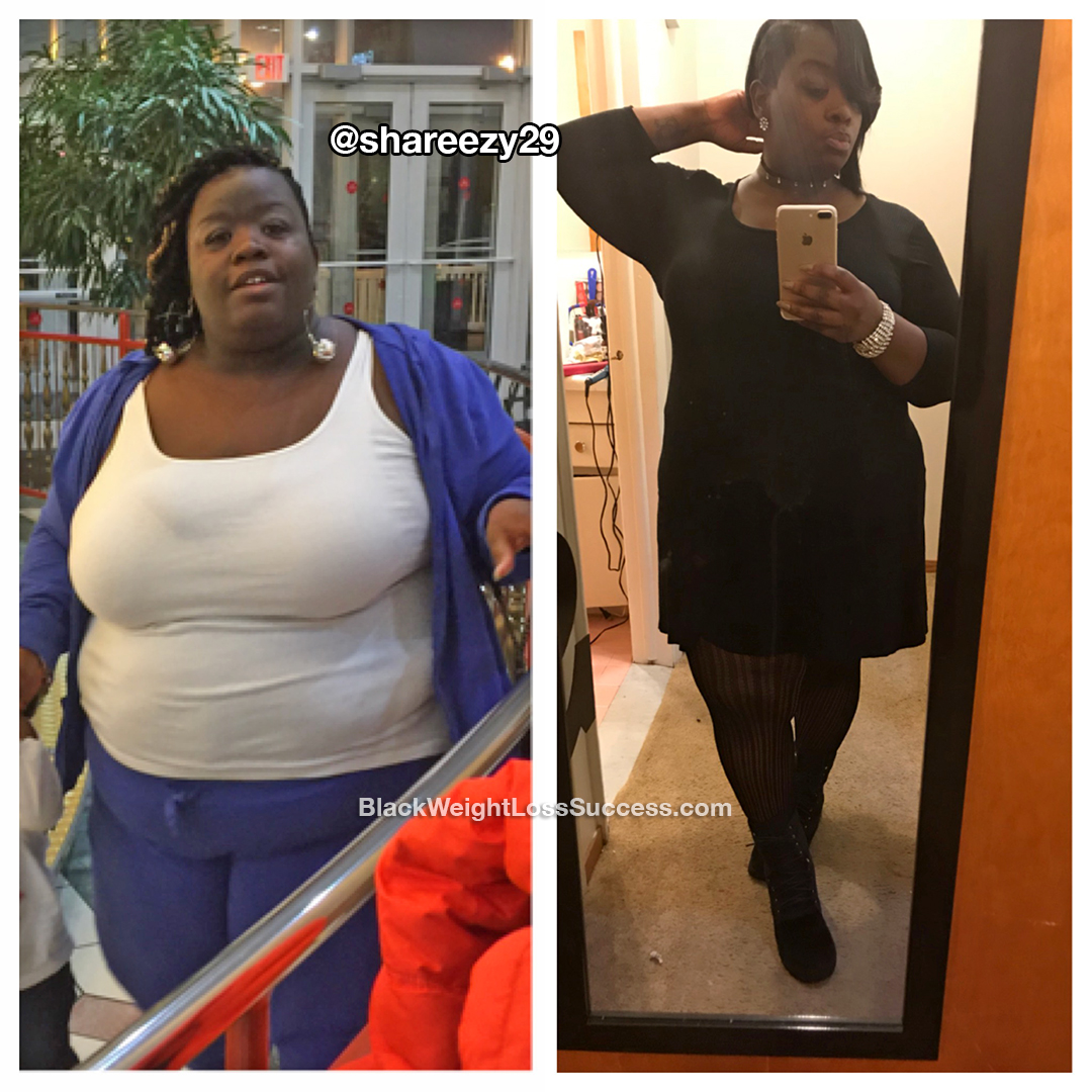 sharonda before and after