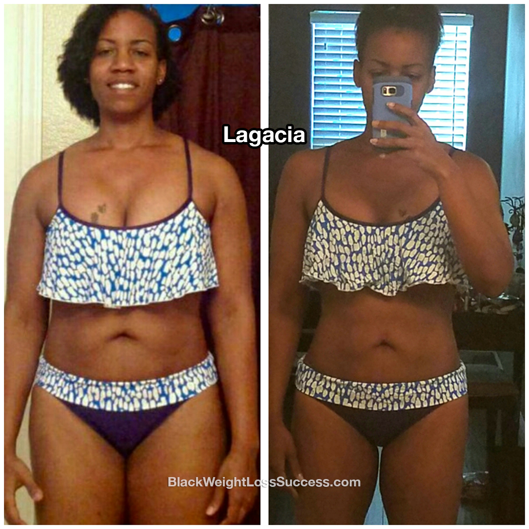 lagacia before and after